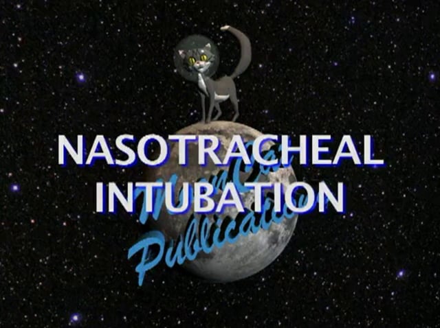 Nasotracheal Intubation