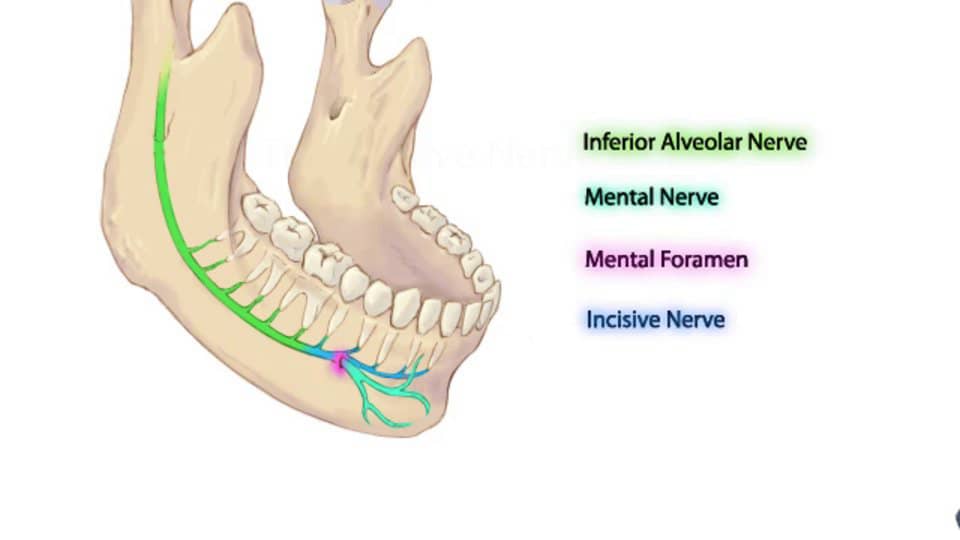 Incisive Nerve Block on Vimeo
