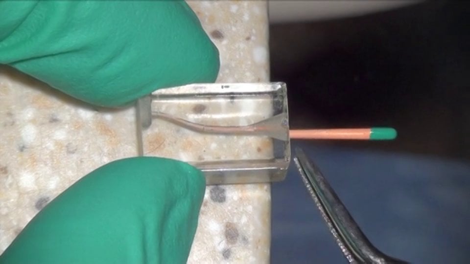 FAQ Hydraulic Condensation Real World Endo Endodontics Educational