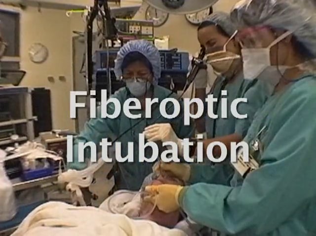 Fiberoptic Intubation
