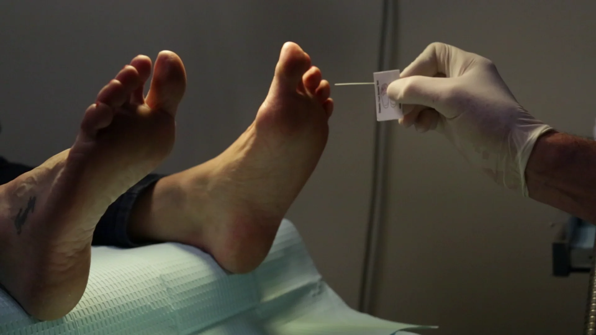 Monofilament Assessment of the Foot - OSCE Guide, Clip, UKMLA
