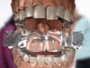 Dental Education Video - Canarsie Braces is an authorized Invisalign distributor.