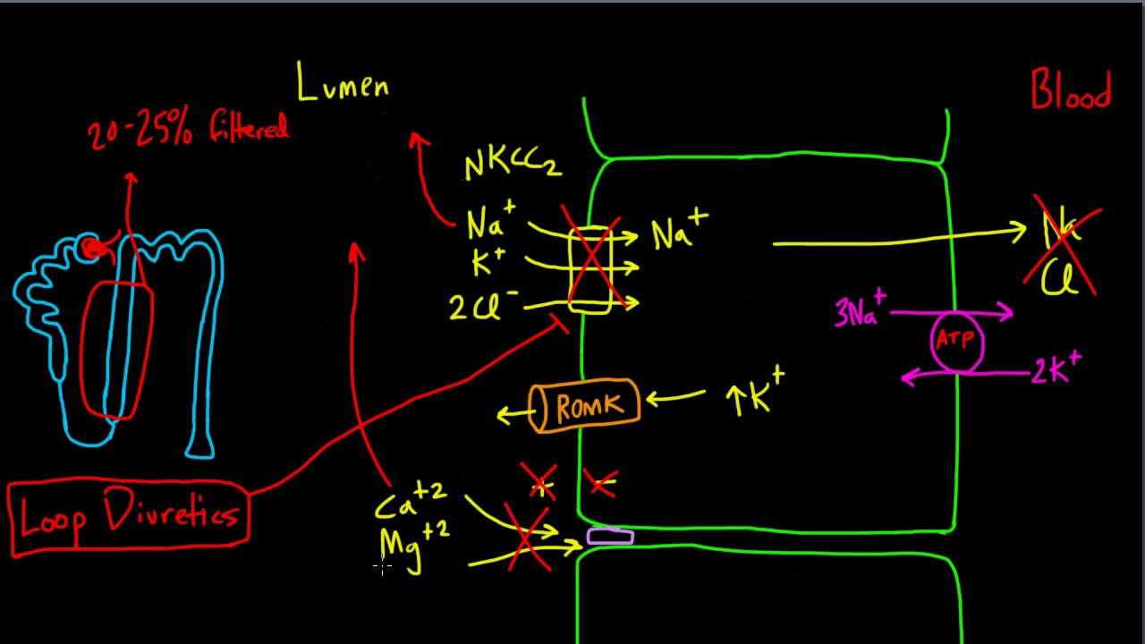 Session 3: Site and Action of Diuretics in Fluids and Electrolytes Duke ...