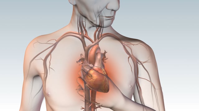 Piedmont Healthcare LV Myocardial Strain Workflow on Siemens SC200 on Vimeo