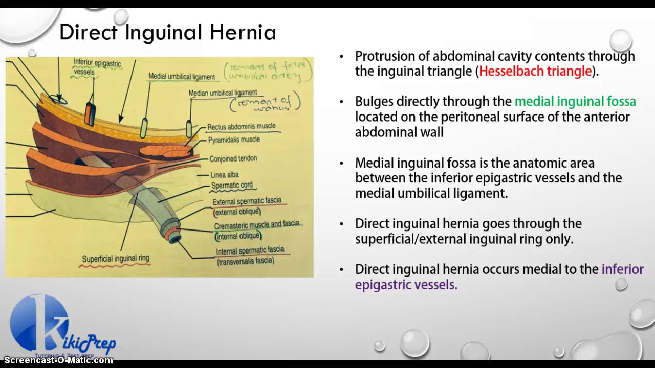 Inguinal hernias- Kikiprep USMLE on Vimeo