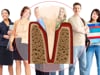 Dental Education Video - Advanced Periodontitis