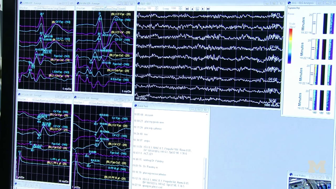 University of Michigan IntraOperative NeuroMonitoring Program