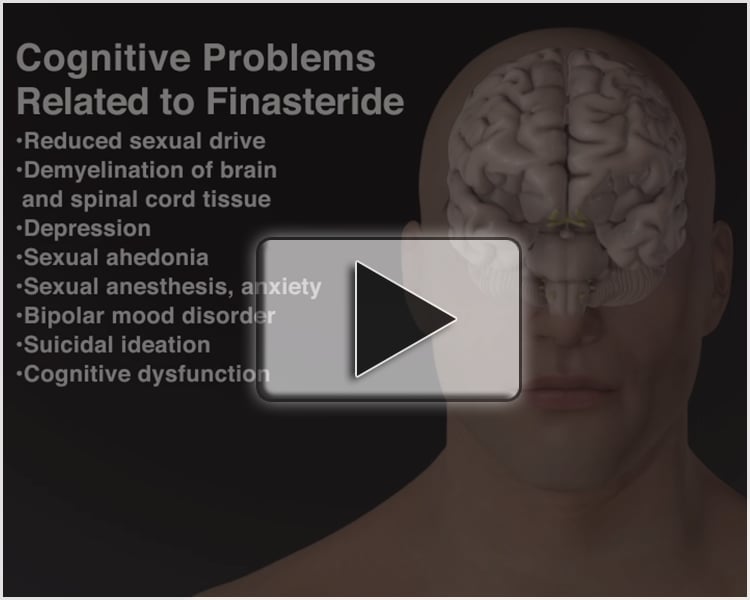 Finasteride Propecia Proscar Side Effects Animation MVI1220