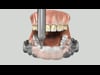 Home Whitening