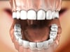 Dental Education Video - Cosmetic Teeth Whitening