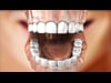 Dental Education Video - ZOOM Whitening