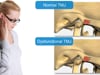 Causes of TMJ/TMD