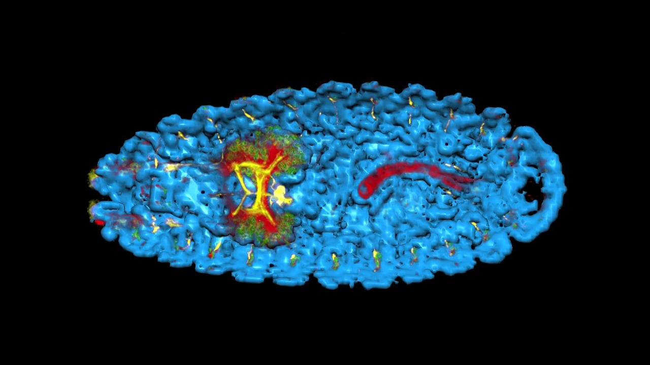 Shane Jinson - 3D with solid DAPI.  MBL Embryology 2014