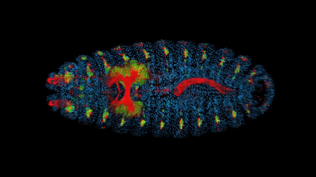 Shane Jinson - 3D.  MBL Embryology 2014
