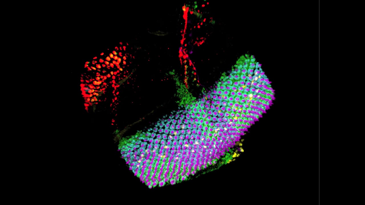 Jiajie Xu - Eye Disk 3D.  MBL Embryology 2014