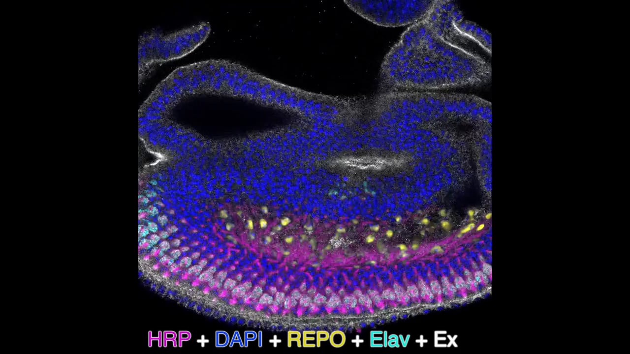 Jiajie Xu - Eye Disk section.  MBL Embryology 2014.