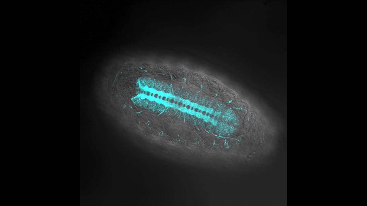 Connie Rich - Seven Channel Section.  MBL Embryology 2014