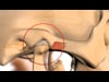Dental Education Video - TMJ / TMD