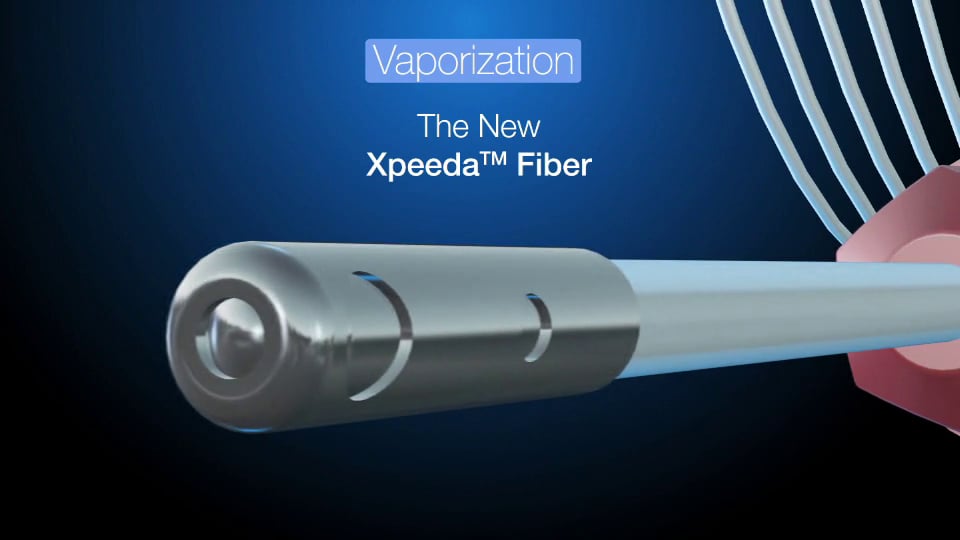 Xpeeda™ Fiber