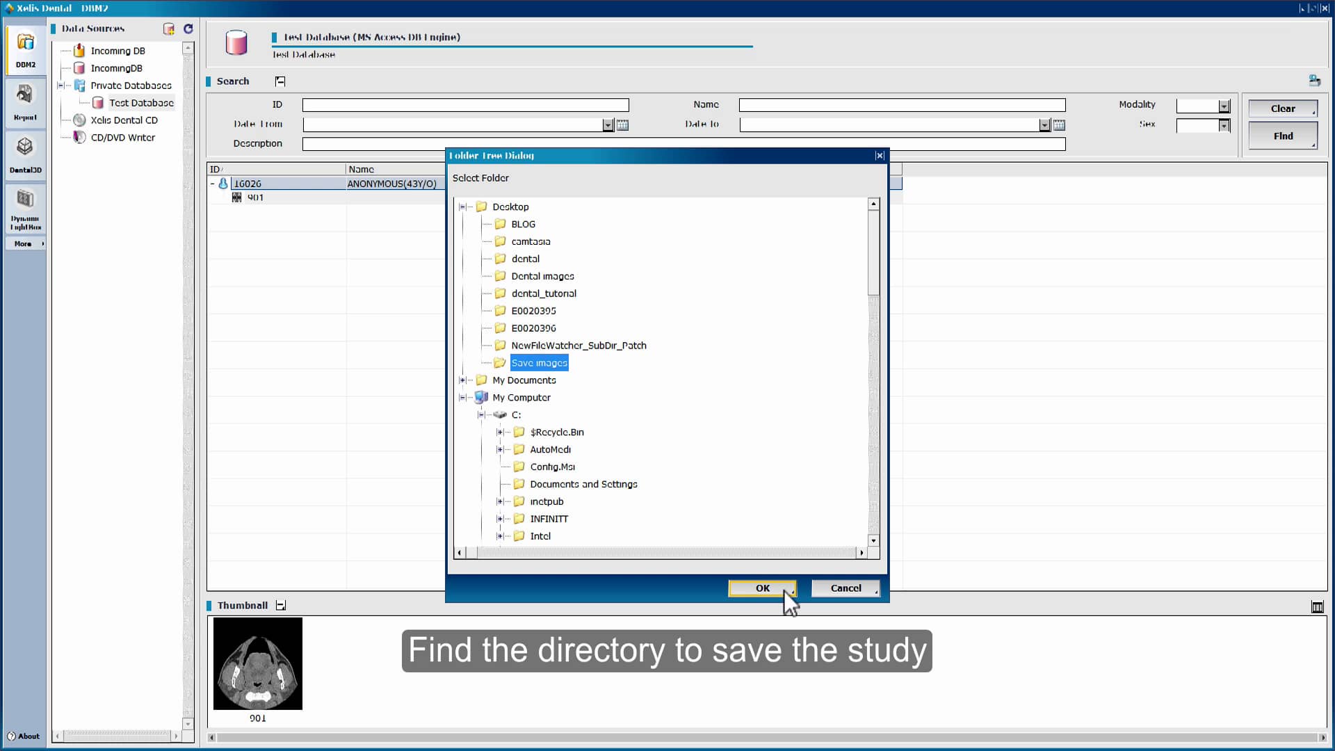 Xelis Dental Save Data To Local PC on Vimeo