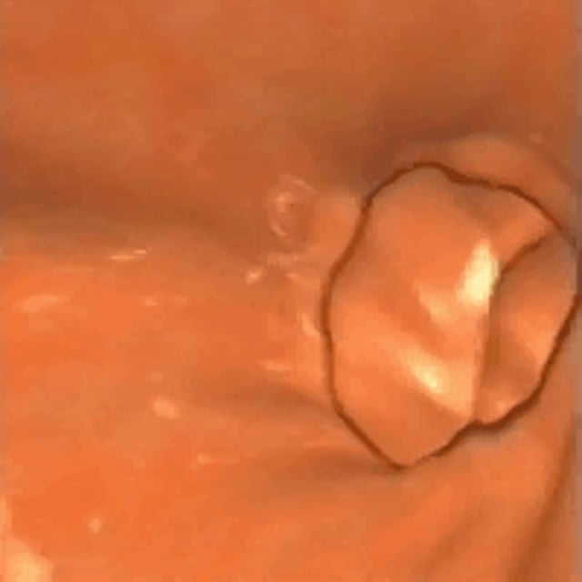 player_thumbnail