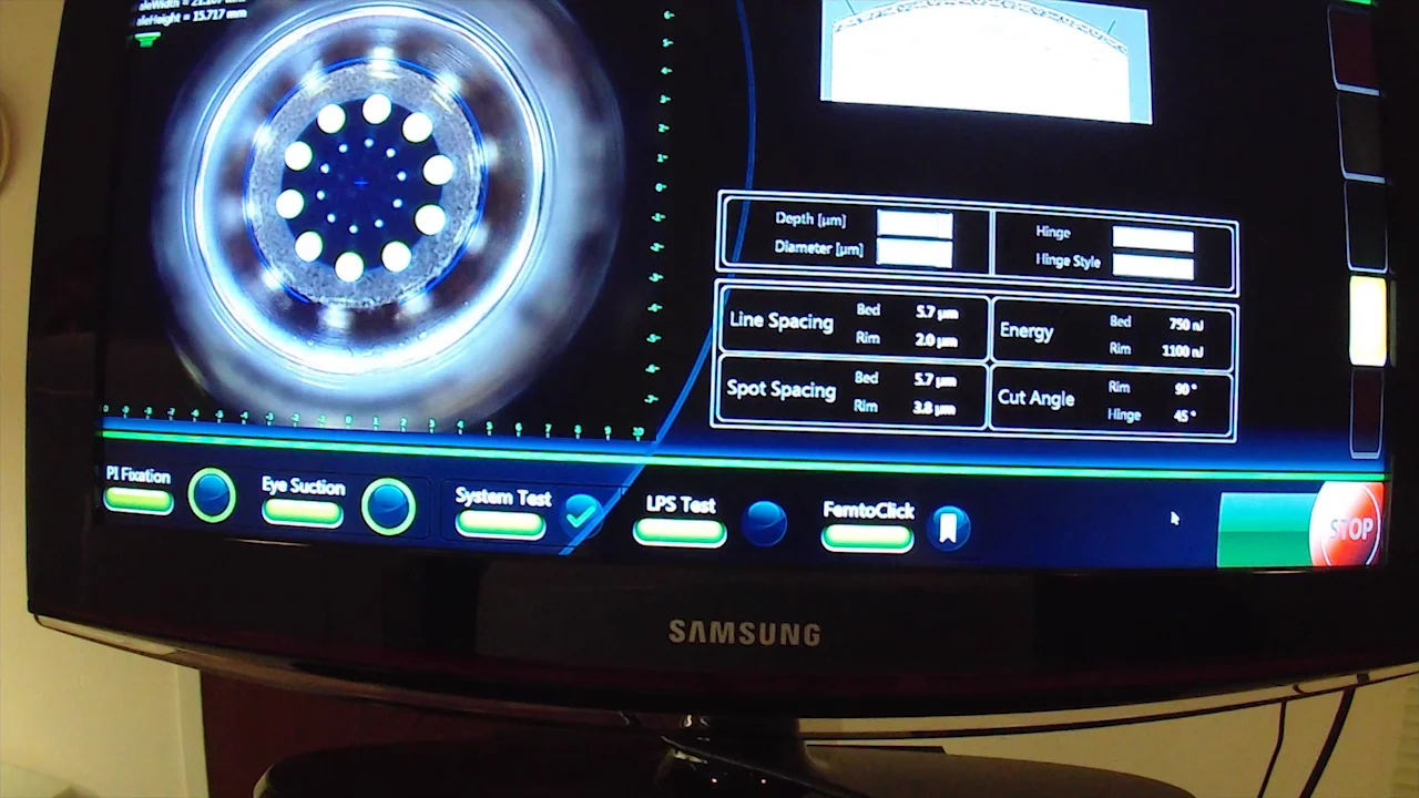BMCG Presentations for review - BMCG ENDL on Vimeo