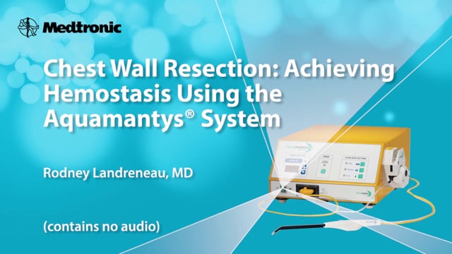 Thoracic Procedures - Medtronic Advanced Energy on Vimeo
