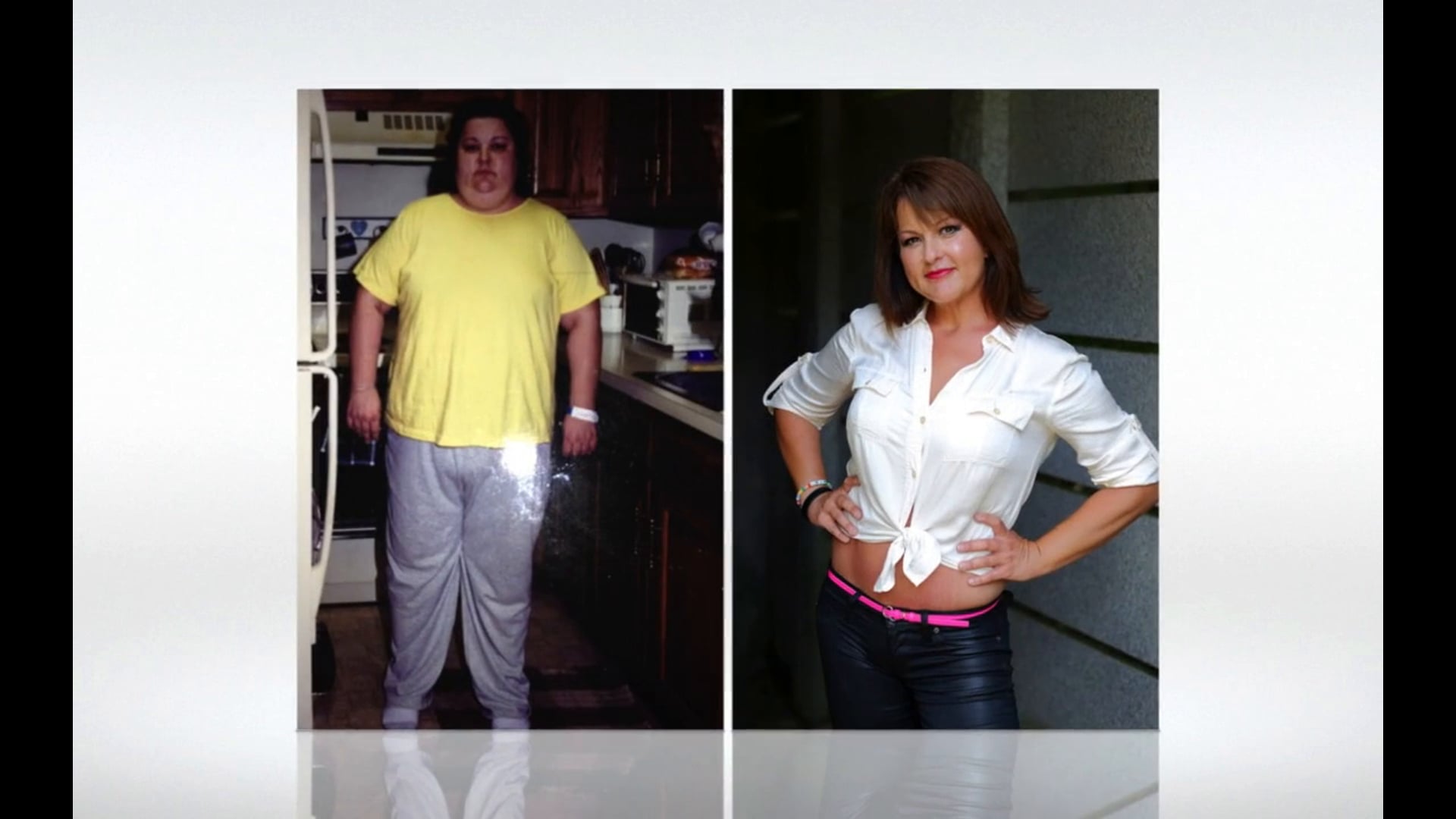 My Bariatric Life AMAZING transformation before and after video photo gallery