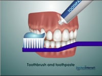 Brushing