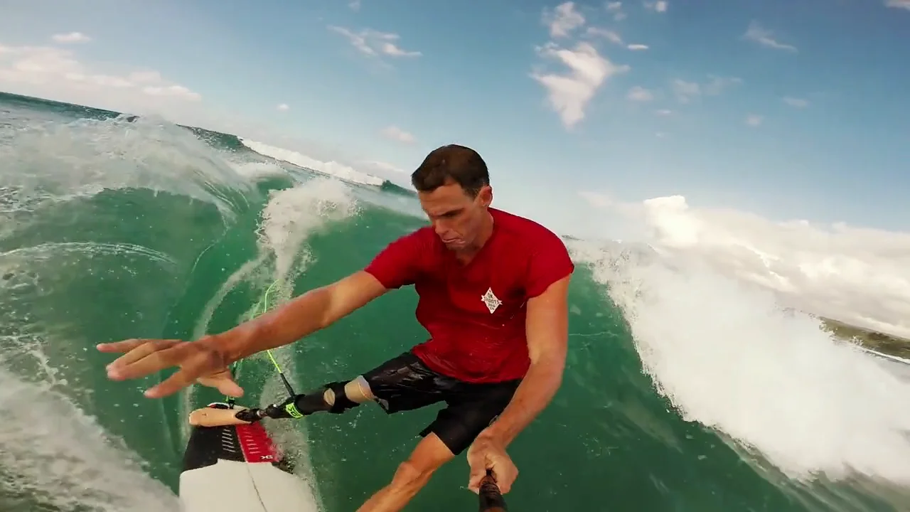 Surfing With A Prosthetic. on Vimeo