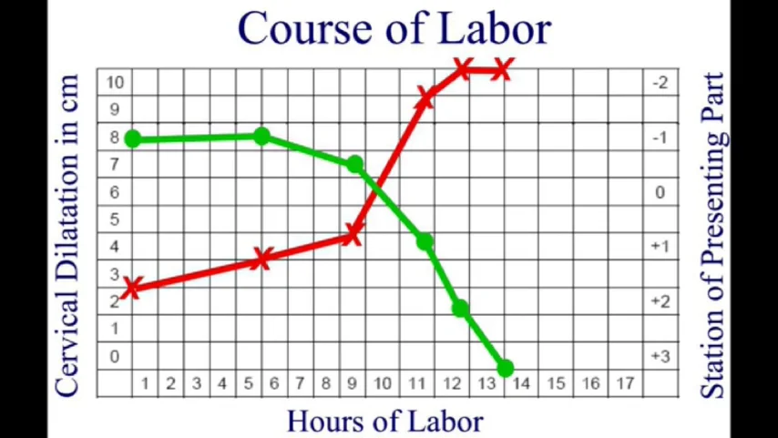 Pelvic Exam During Labor