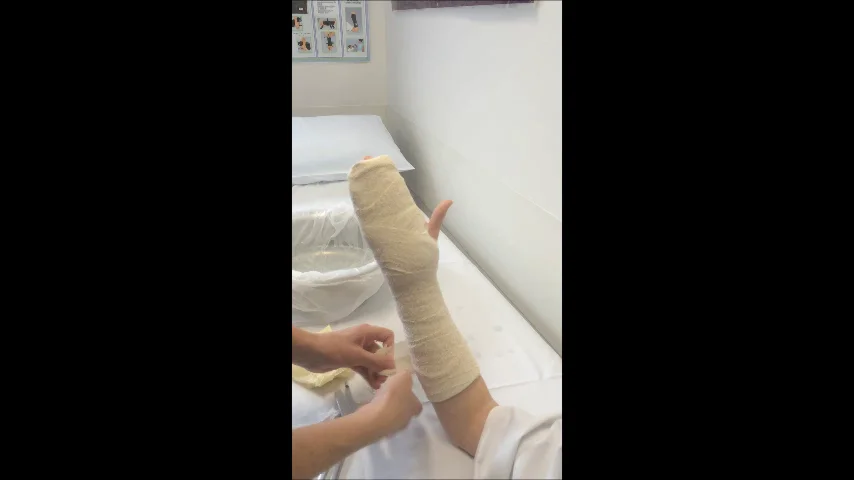 Children Limb Splints - posi splint.wmp on Vimeo