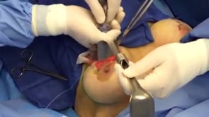 news video image