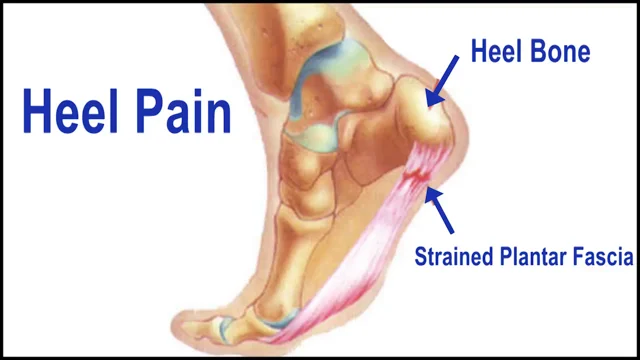 Ankle heel pain tendon sale