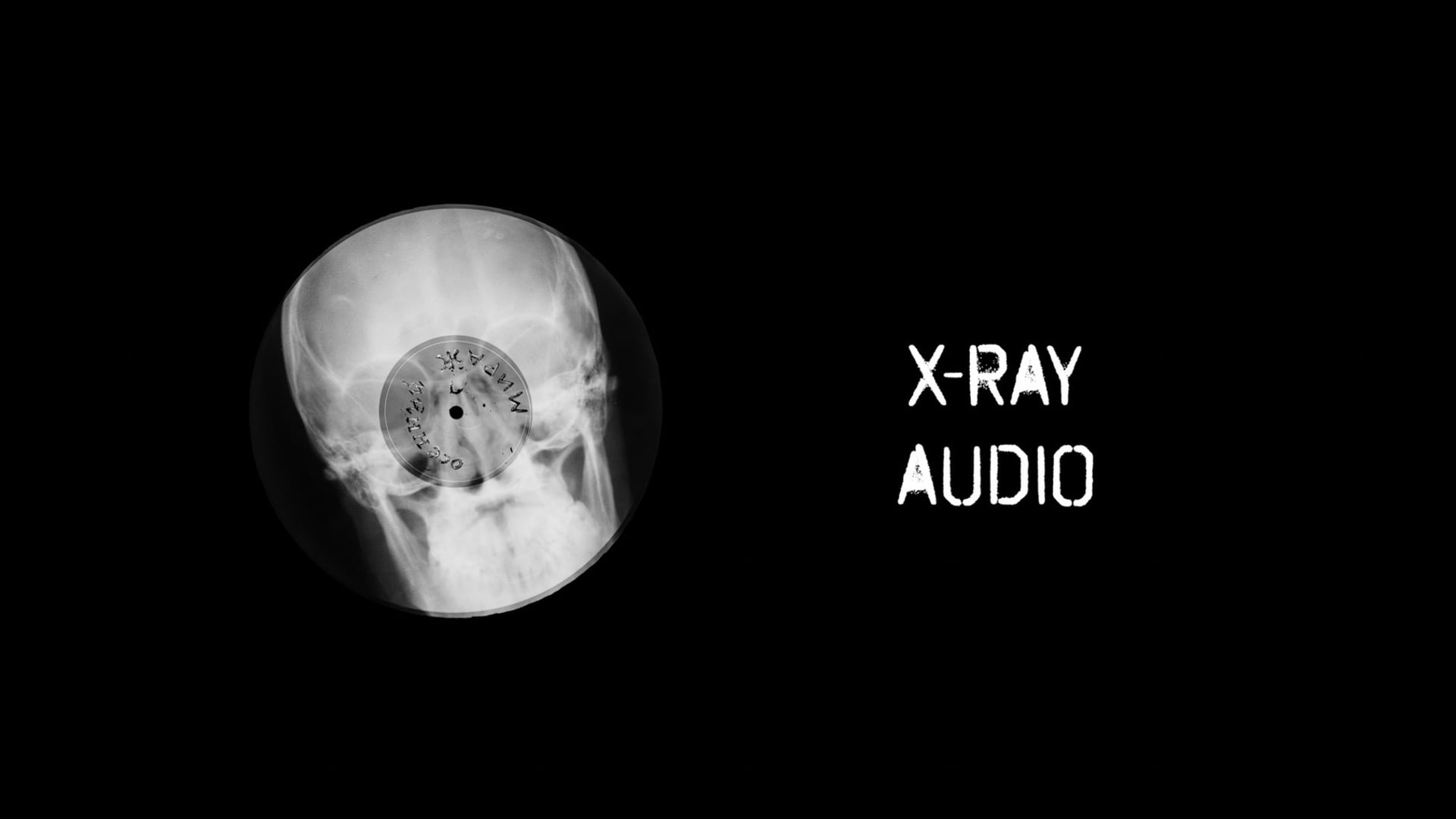 X-ray audio