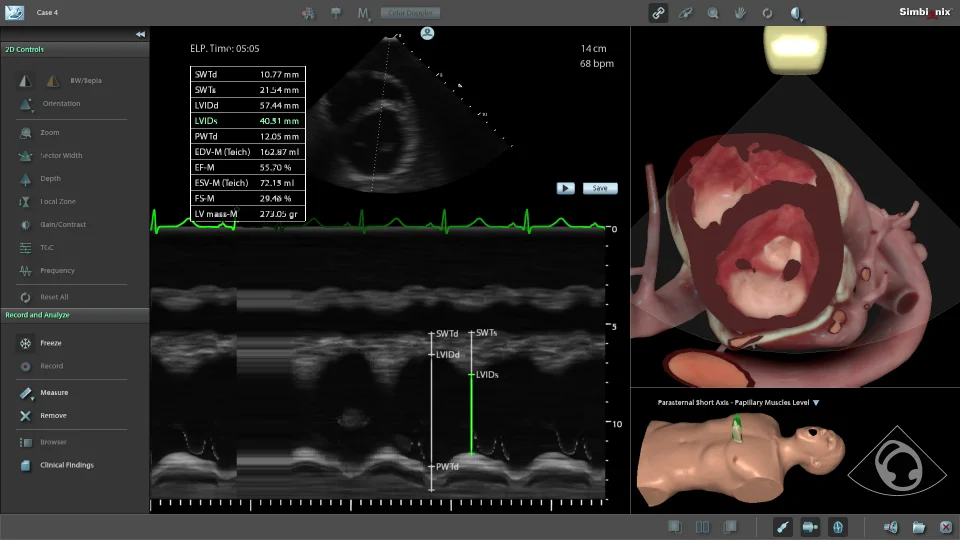 Advanced Echo Module - Surgical Science