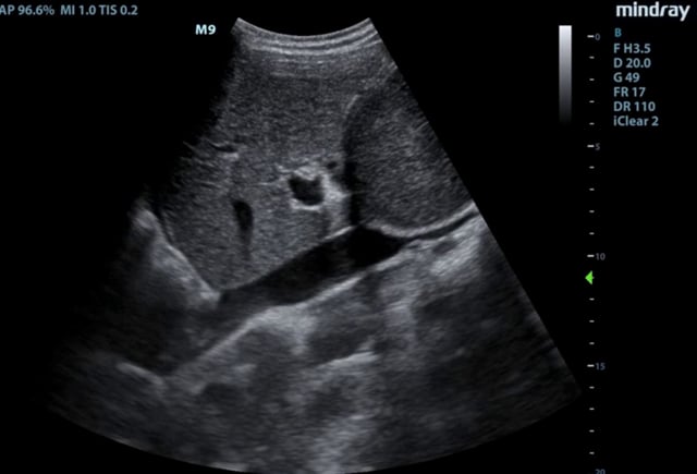 Hennepin Ultrasound