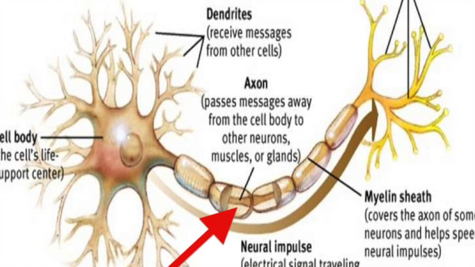 MS Neurons, Axons, Myelin Sheath and Demyelinisation on Vimeo