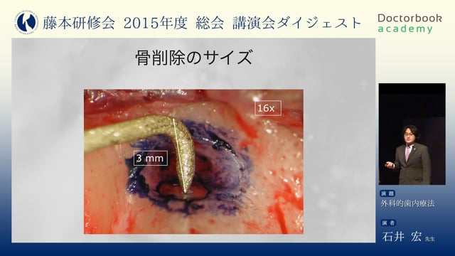 #2 外科的歯内療法/アンカースクリュー 部分矯正の第一歩