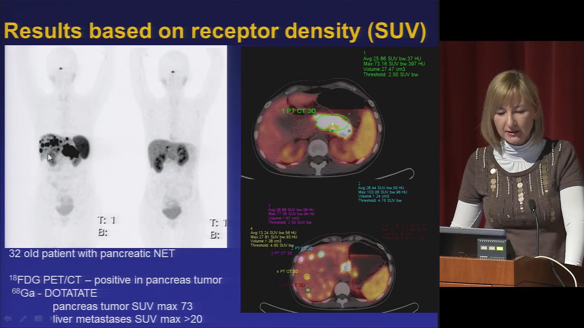 2.36 Long Term Side Effects Under Tandem PRRT Y90/Lu177 - Jolanta ...