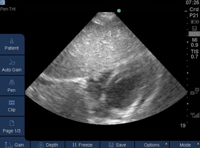 Hennepin Ultrasound