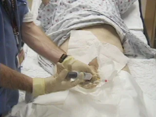 Male urethral catherisation demonstration video  