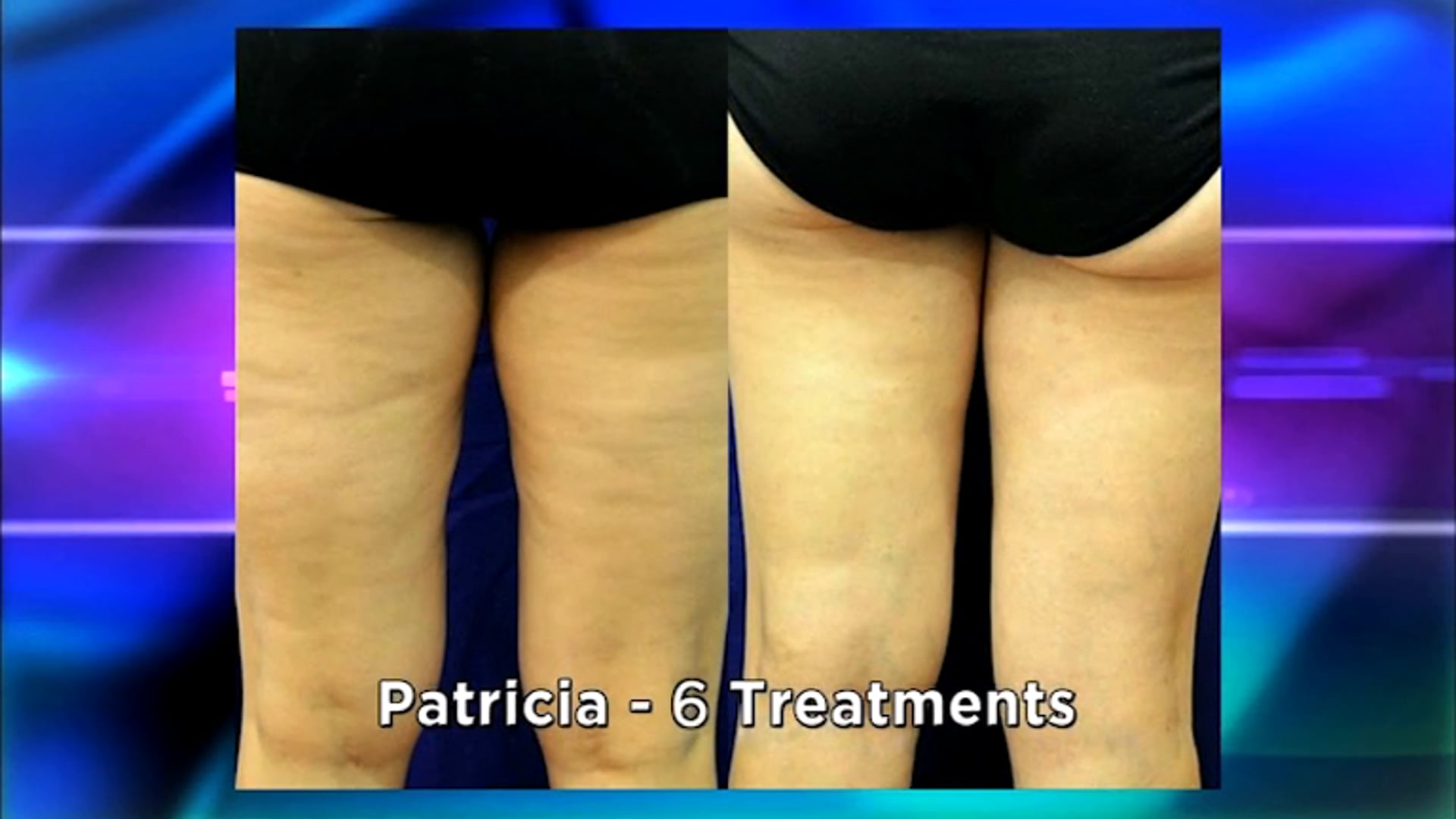 The Doctors put BodyFX to the test