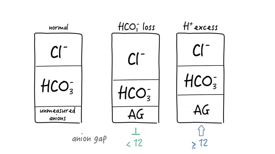 Bicarbonate loss and acid overload