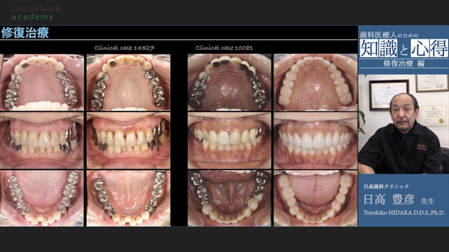 日高豊彦先生による修復治療講座