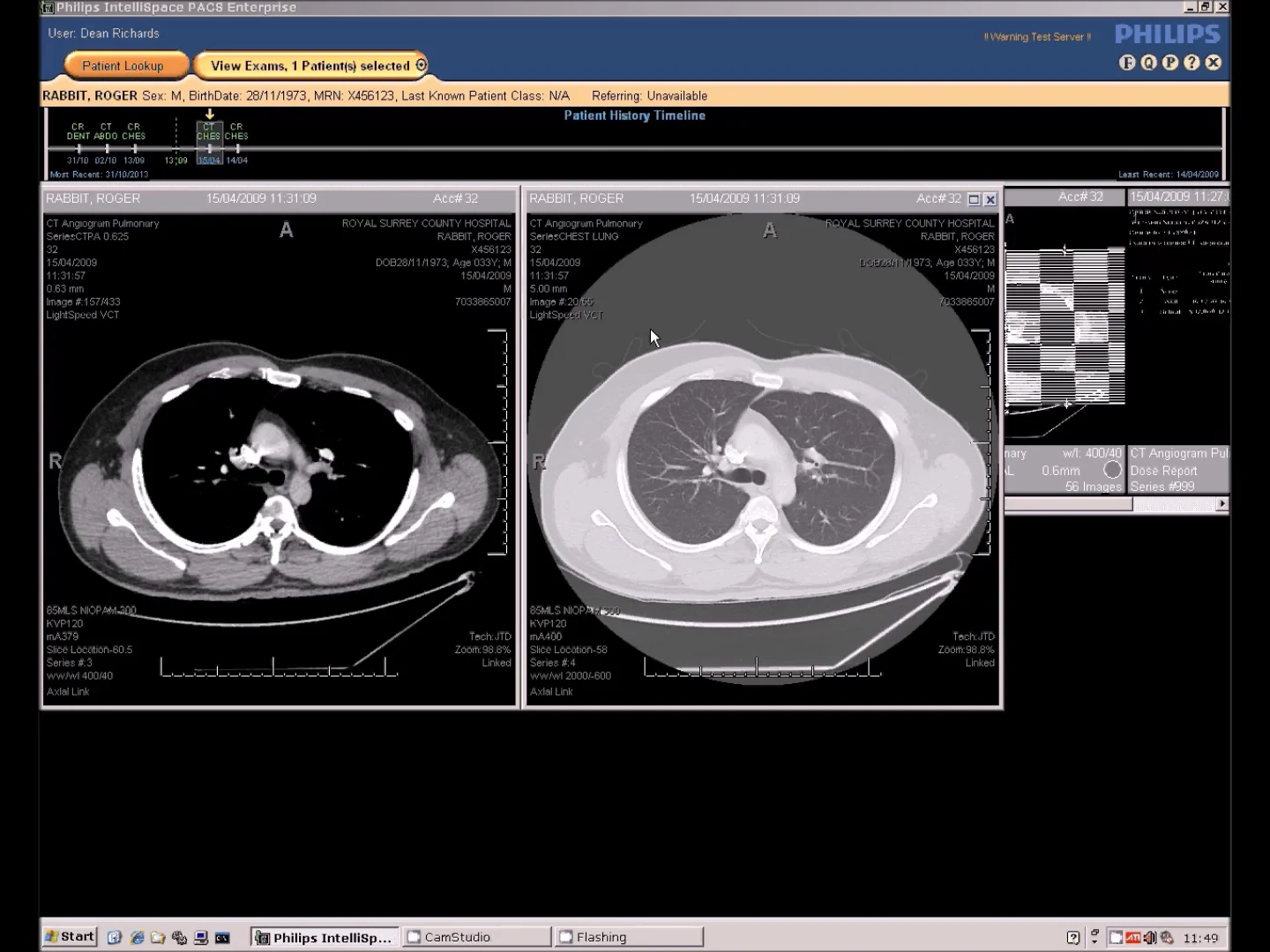 RSCH PACS Training - Trust user edition on Vimeo