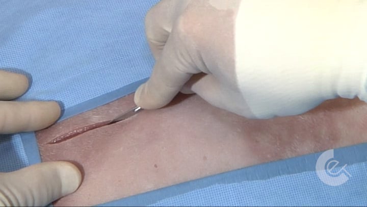 Using Surgical Tools - Scalpel Incision Methods - Slide Cut on Vimeo
