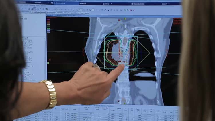 What to expect during radiation therapy