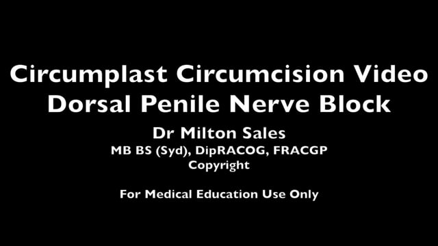 Circumplast Circumcision