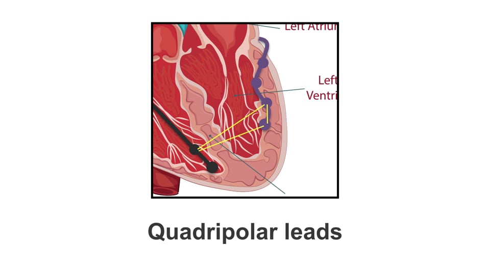 Troubleshooting with vectors
